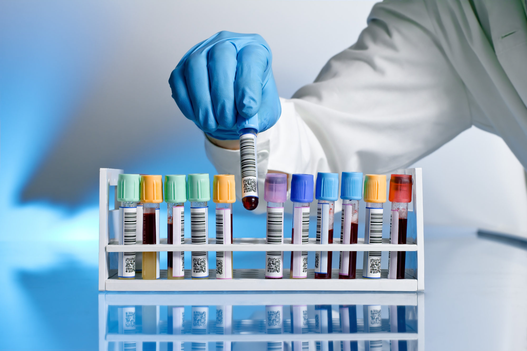 Reliable Drug Testing Services in Chicago IL